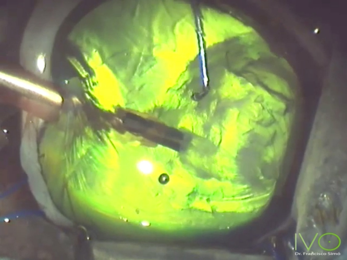 Facoemulsificación catarata veterinaria