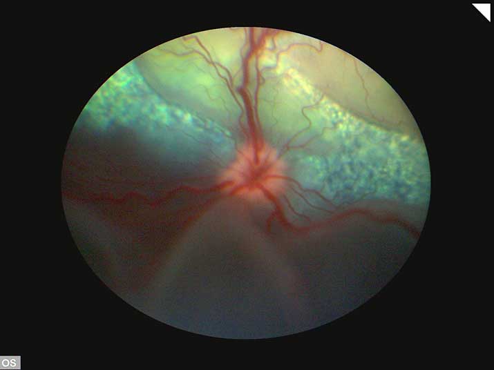 Desprendimiento de retina de un perro