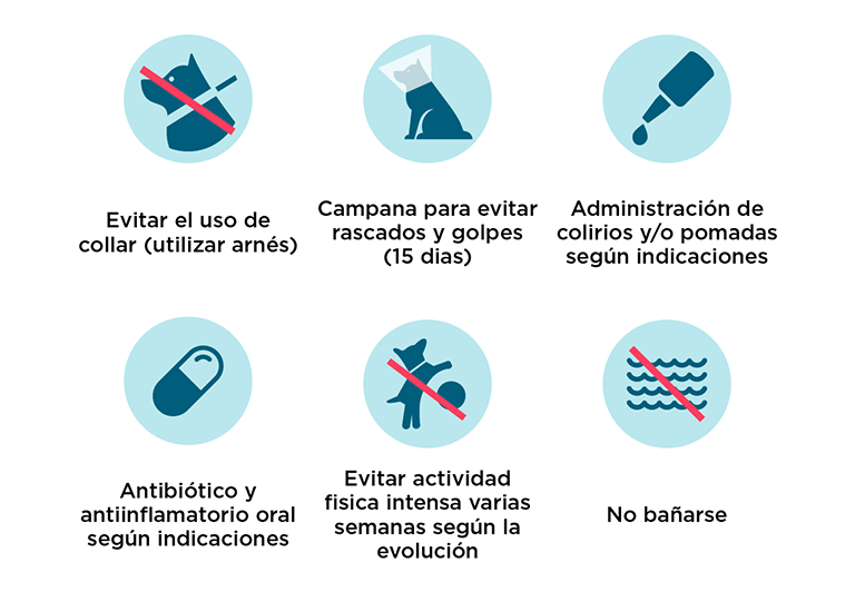 Vitrectomía: después de la intervención
