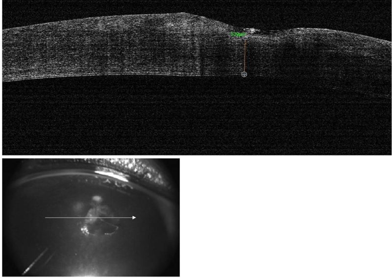 OCT perro distrofia lipidica corneal - Caso Apolo