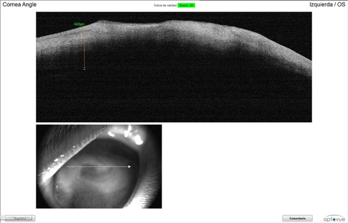 OCT previa a la queratectomía en gato