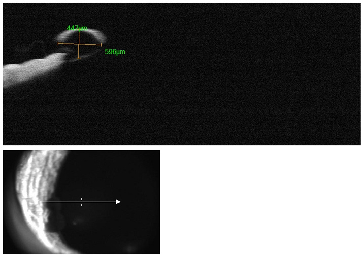 OCT-tomografia-coherencia-optica-gato