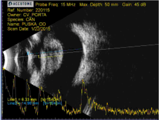 Ecografía ojo microftálmico con catarata