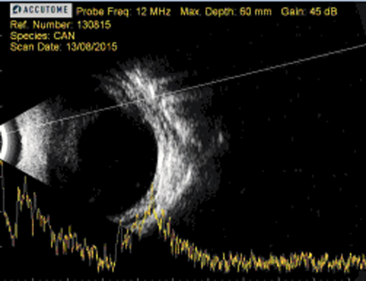 Perforacion-corneal-Eco-Fiona