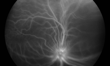 Angiografía en perro - Caso luxacion cristalino Rio