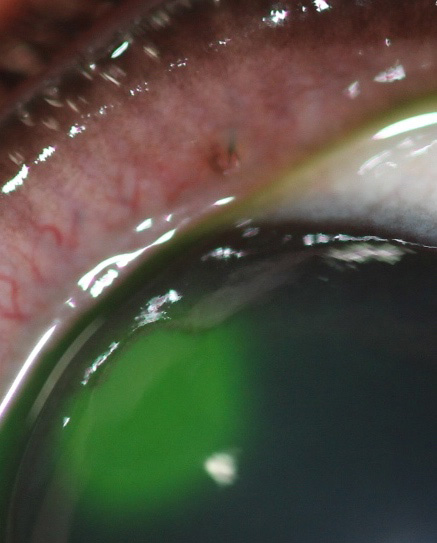 cilio-ectopico-perro-chihuahua