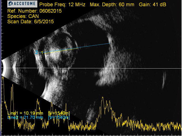 Ecografía cristalino perro con catarata diabética