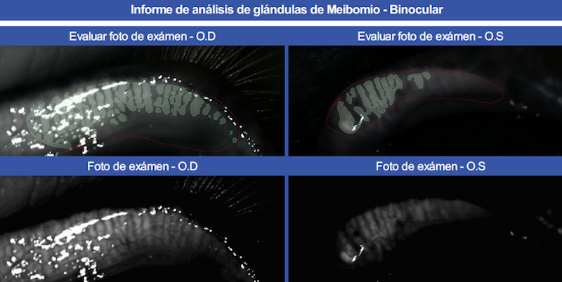 Meibografía infrarroja en caballo