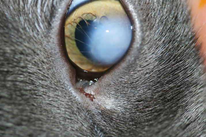 Membrana pupilar persistente