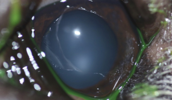 Ojo izquierdo de Brutus