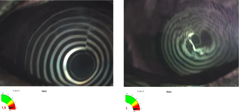 Evaluación de la película lagrimal mediante NIBUT OU