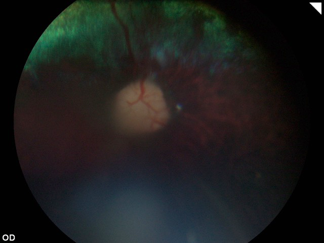 Retinografia postcirugia vitrectomia perro