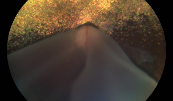 Retinografia perro con desprendimento de retina - Caso Fox