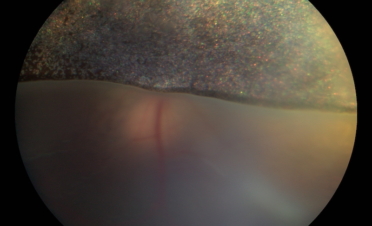 Retinografia perro con desprendimento de retina - Caso Fox