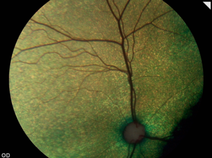 Retinografía ocular gato