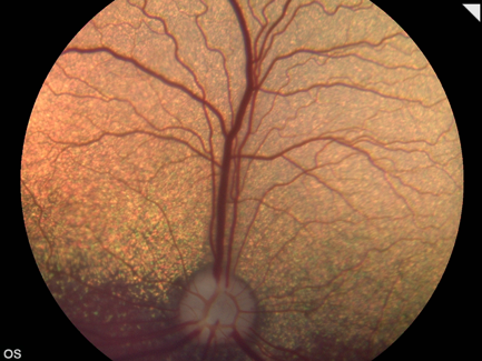 Retinografía ocular perro