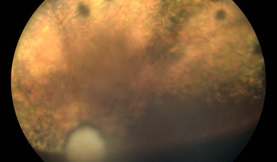 Retinografia perro post vitrectomia por desprendimento de retina - Caso Fox