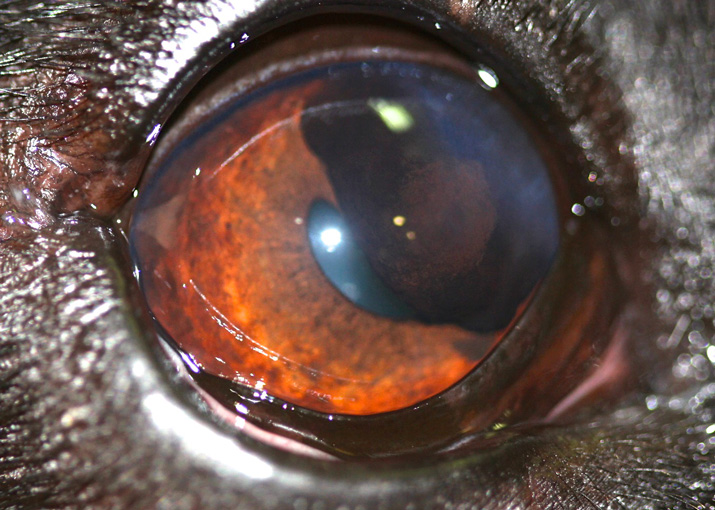 Tumor ocular benigno afecta iris