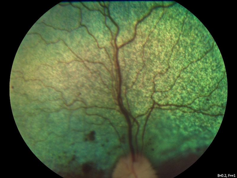 Hemorragia con inflamación coroides en un perro